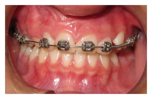 Details are in the caption following the image Details are in the caption following the image