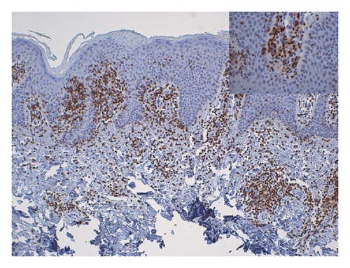 Details are in the caption following the image