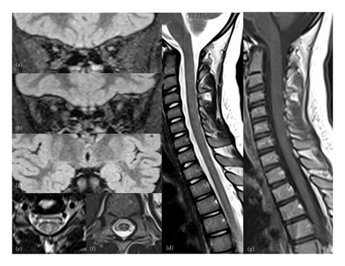 Details are in the caption following the image Details are in the caption following the image
