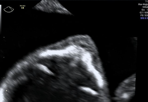 Details are in the caption following the image