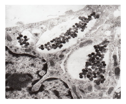 Details are in the caption following the image