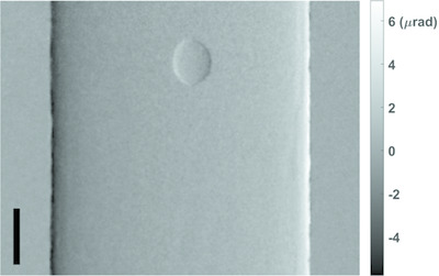 Single-image phase retrieval for hard X-ray grating interferometry