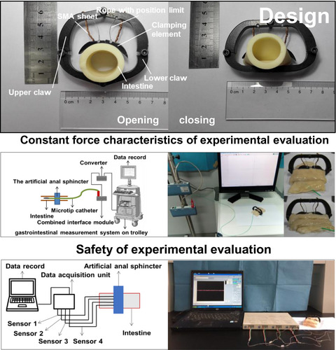 Experimental assessment of a novel artificial anal sphincter with shape memory alloy