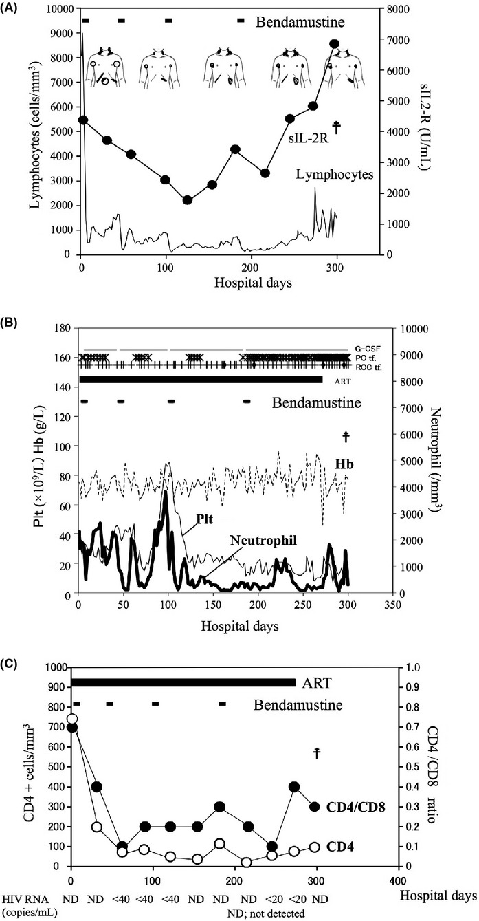 Treatment of chronic lymphocytic leukemia with bendamustine in an HIV-infected patient on antiretroviral therapy: a case report and review of the literature