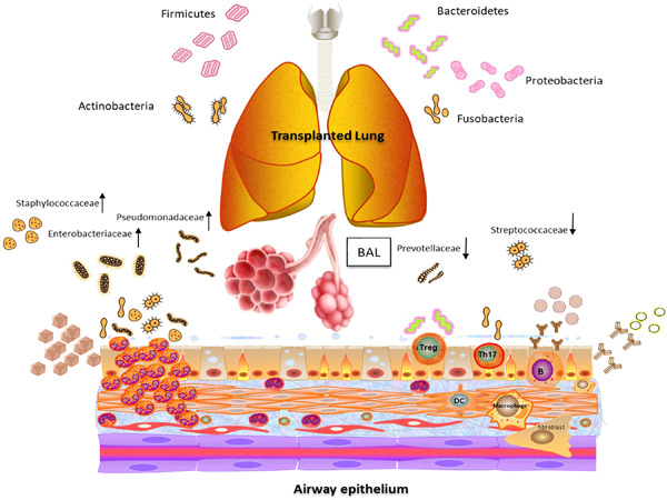 Microbiosis in lung allotransplantation and xenotransplantation: State of the art and future perspective