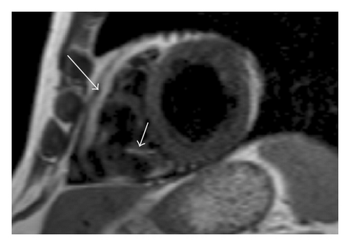 Details are in the caption following the image