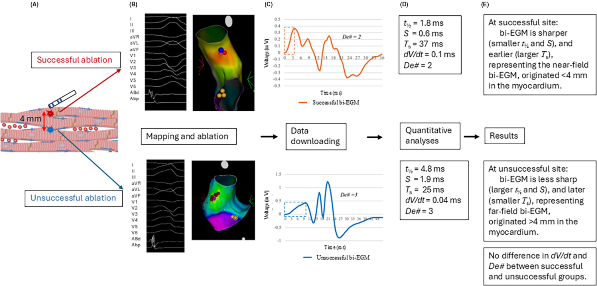 Quantitative analyses of the distal bipolar electrogram for focal premature ventricular contraction ablation