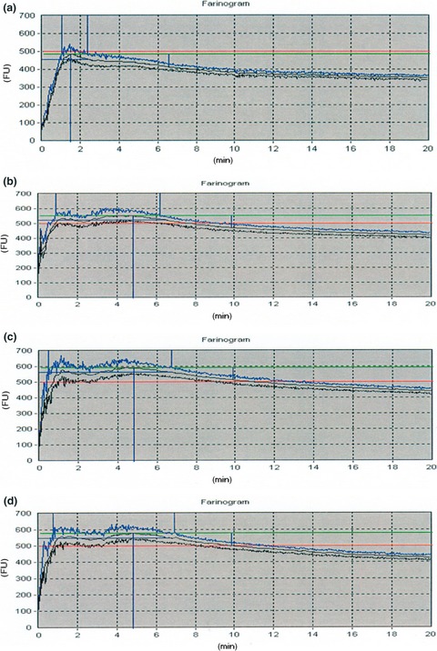Effect of drying methods and blending ratios on dough rheological properties, physical and sensory properties of wheat–taro flour composite bread