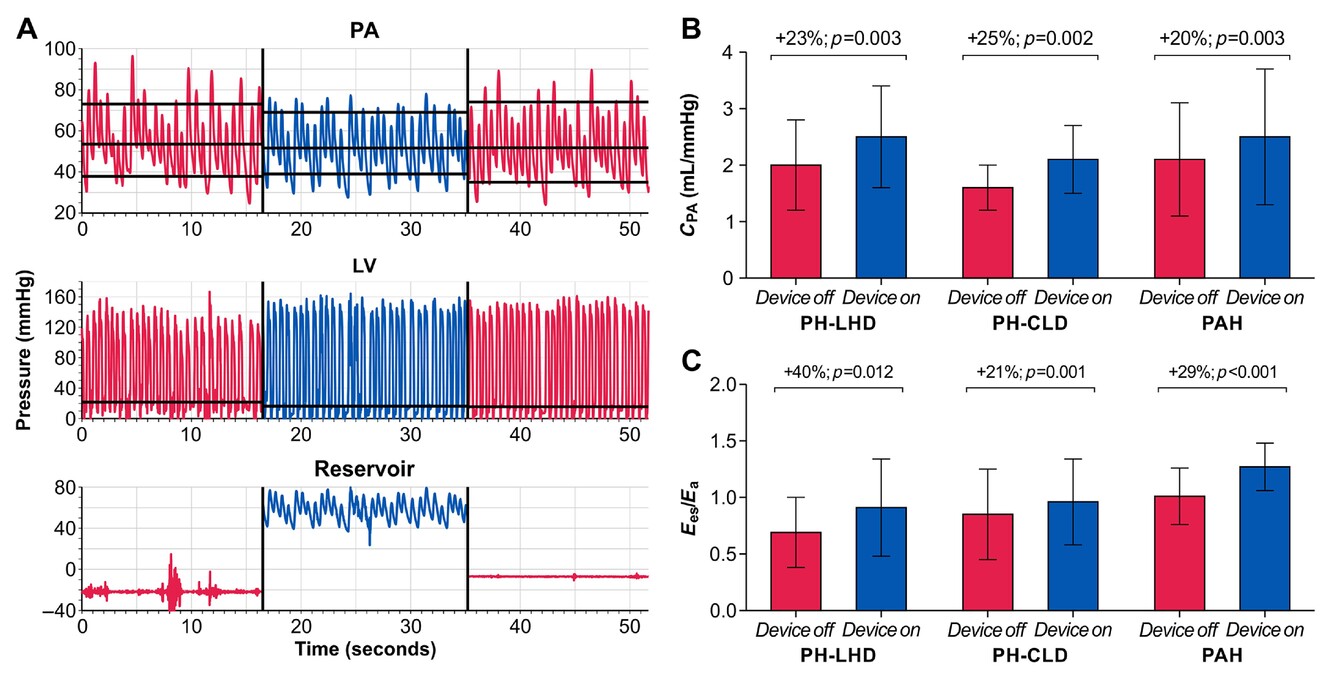 Efficacy and safety of the Aria pulmonary endovascular device in pulmonary hypertension