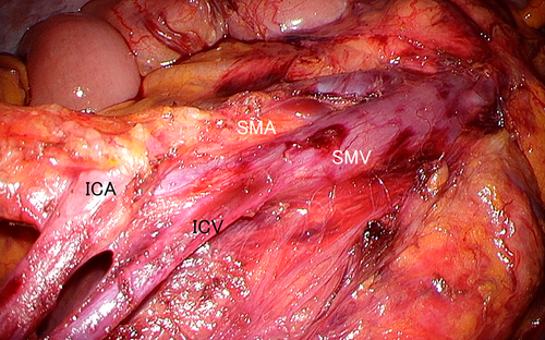 Details are in the caption following the image Details are in the caption following the image