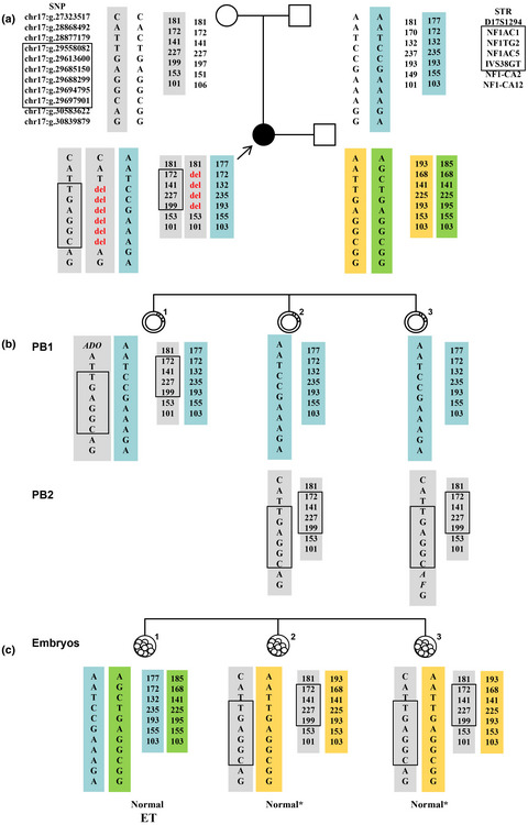 Next-generation sequence-based preimplantation genetic testing for monogenic disease resulting from maternal mosaicism