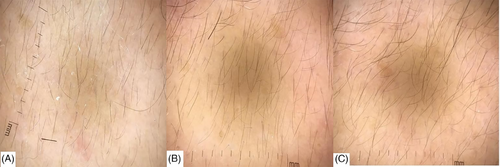 Details are in the caption following the image Details are in the caption following the image