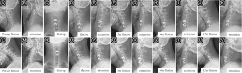 Details are in the caption following the image Details are in the caption following the image
