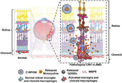 MMP9-Responsive Graphene Oxide Quantum Dot-Based Nano-in-Micro Drug Delivery System for Combinatorial Therapy of Choroidal Neovascularization