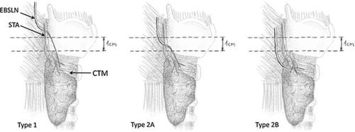 Details are in the caption following the image