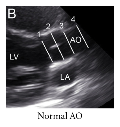 Details are in the caption following the image