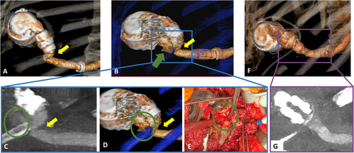 Details are in the caption following the image Details are in the caption following the image