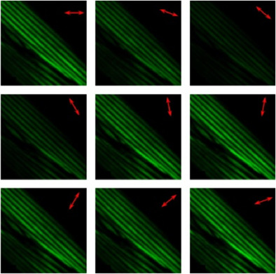 Monitoring aging-associated structural alterations in Caenorhabditis elegans striated muscles via polarization-dependent second-harmonic generation measurements
