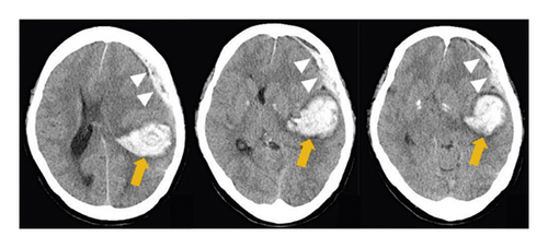 Details are in the caption following the image Details are in the caption following the image