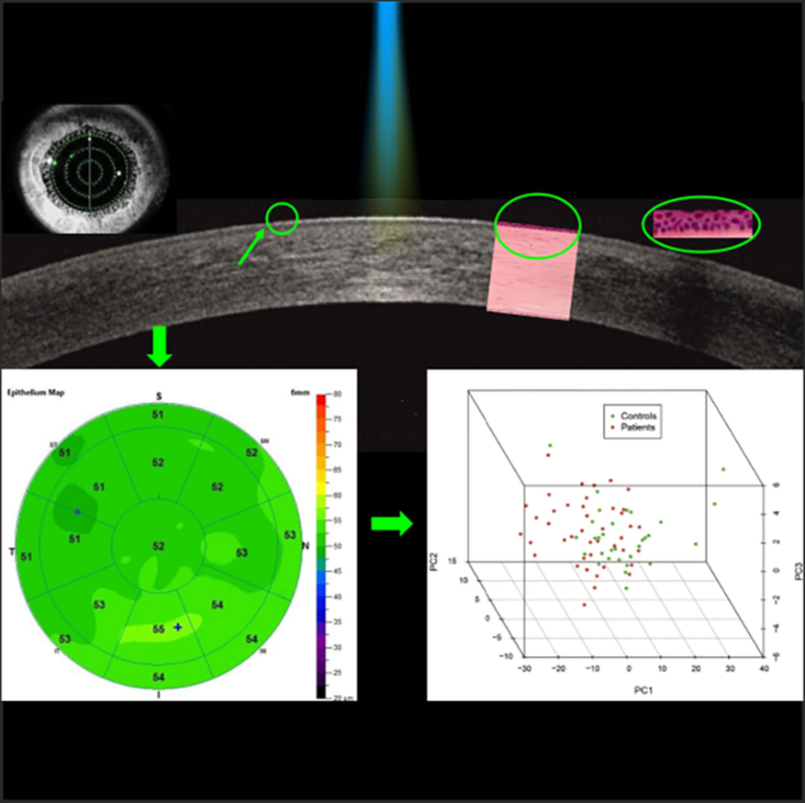 Evaluation of corneal epithelial thickness in glaucomatous patients using anterior-segment optical coherence tomography