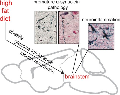 Diet-induced obesity accelerates the onset of terminal phenotypes in α-synuclein transgenic mice