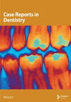 Case Reports in Dentistry