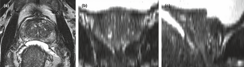 Details are in the caption following the image