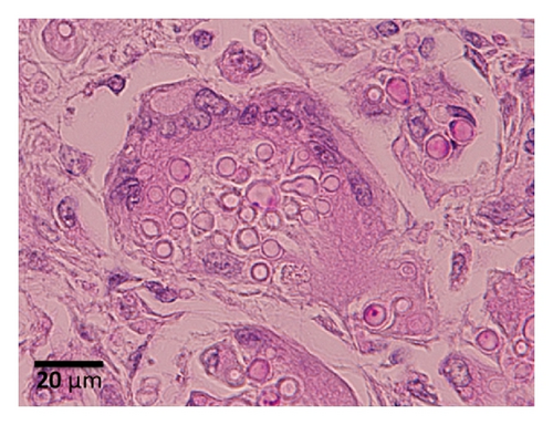 Details are in the caption following the image