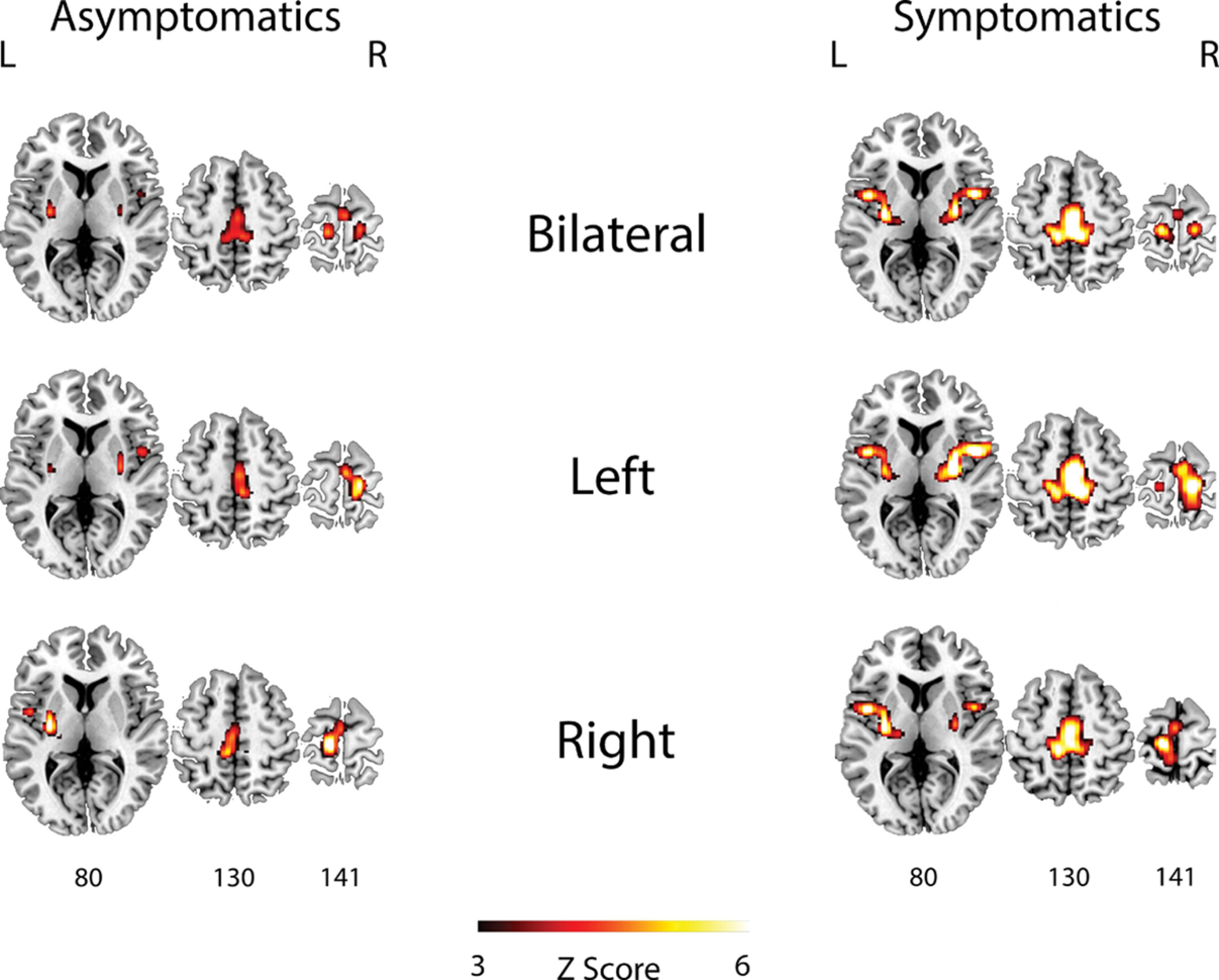 Brain Activation and Functional Connectivity During Performance of Lumbopelvic Motor Tasks in Individuals With and Without Low Back Pain: A Functional Magnetic Resonance Imaging Study