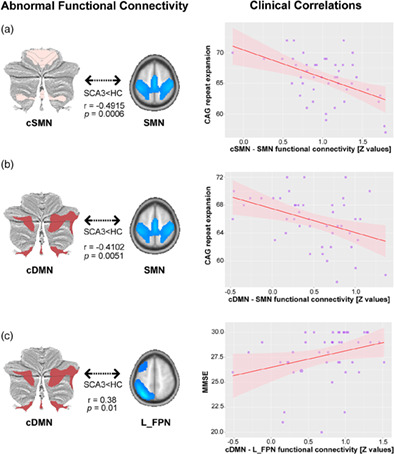 Cerebello-cerebral resting-state functional connectivity in spinocerebellar ataxia type 3
