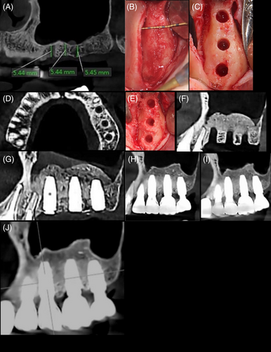 Details are in the caption following the image Details are in the caption following the image
