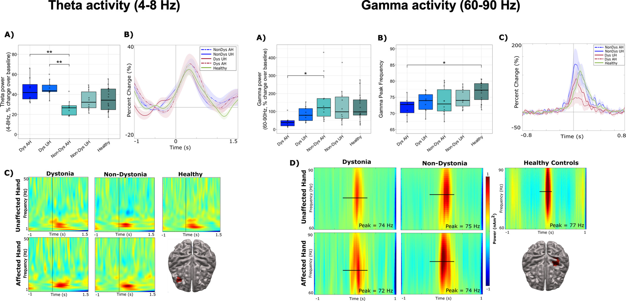 Cortical Oscillatory Activity and Motor Control in Pediatric Stroke Patients With Hemidystonia