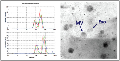Expression analysis of extracellular microRNA in bronchoalveolar lavage fluid from patients with pulmonary sarcoidosis