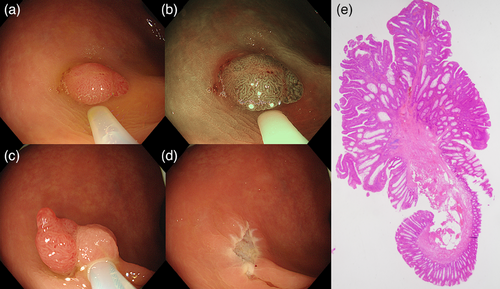Details are in the caption following the image Details are in the caption following the image