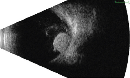 Details are in the caption following the image