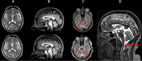 Details are in the caption following the image Details are in the caption following the image