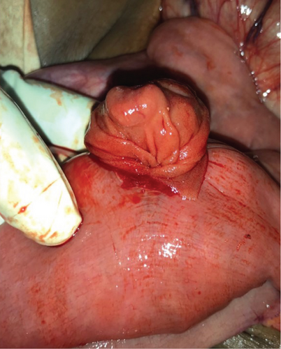 Details are in the caption following the image Details are in the caption following the image