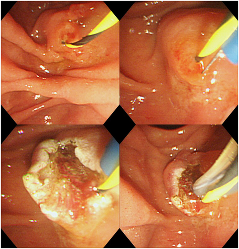 Details are in the caption following the image Details are in the caption following the image
