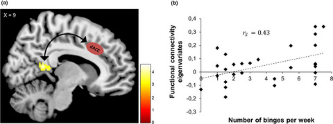 Altered functional connectivity in binge eating disorder and bulimia nervosa: A resting-state fMRI study