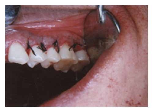 Details are in the caption following the image Details are in the caption following the image