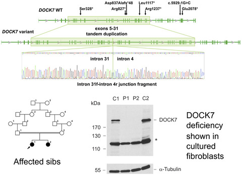 Characteristic facial features and cortical blindness distinguish the DOCK7-related epileptic encephalopathy