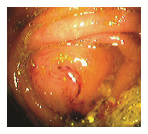 Details are in the caption following the image Details are in the caption following the image