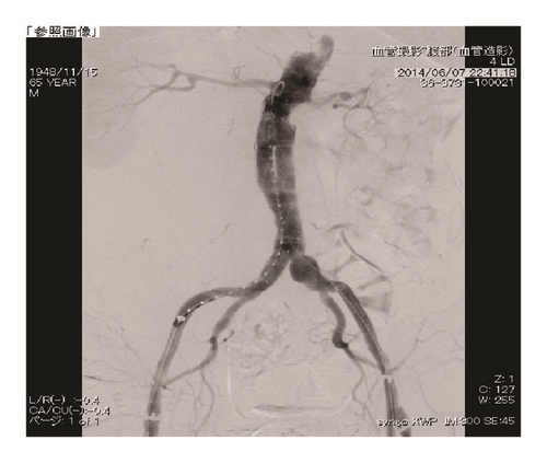 Details are in the caption following the image Details are in the caption following the image