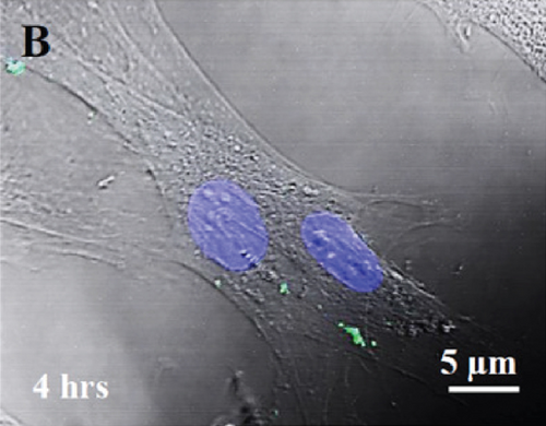 Details are in the caption following the image