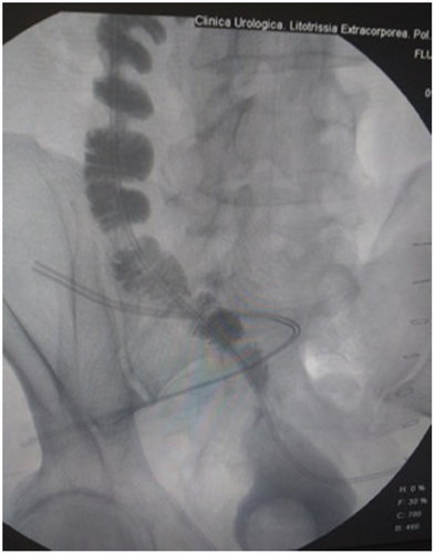 Details are in the caption following the image Details are in the caption following the image