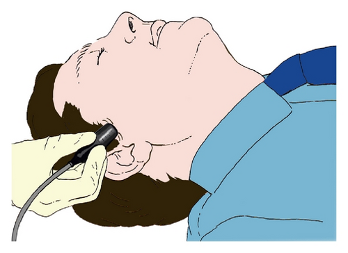 Details are in the caption following the image