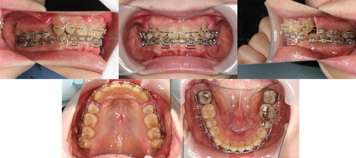 Details are in the caption following the image Details are in the caption following the image