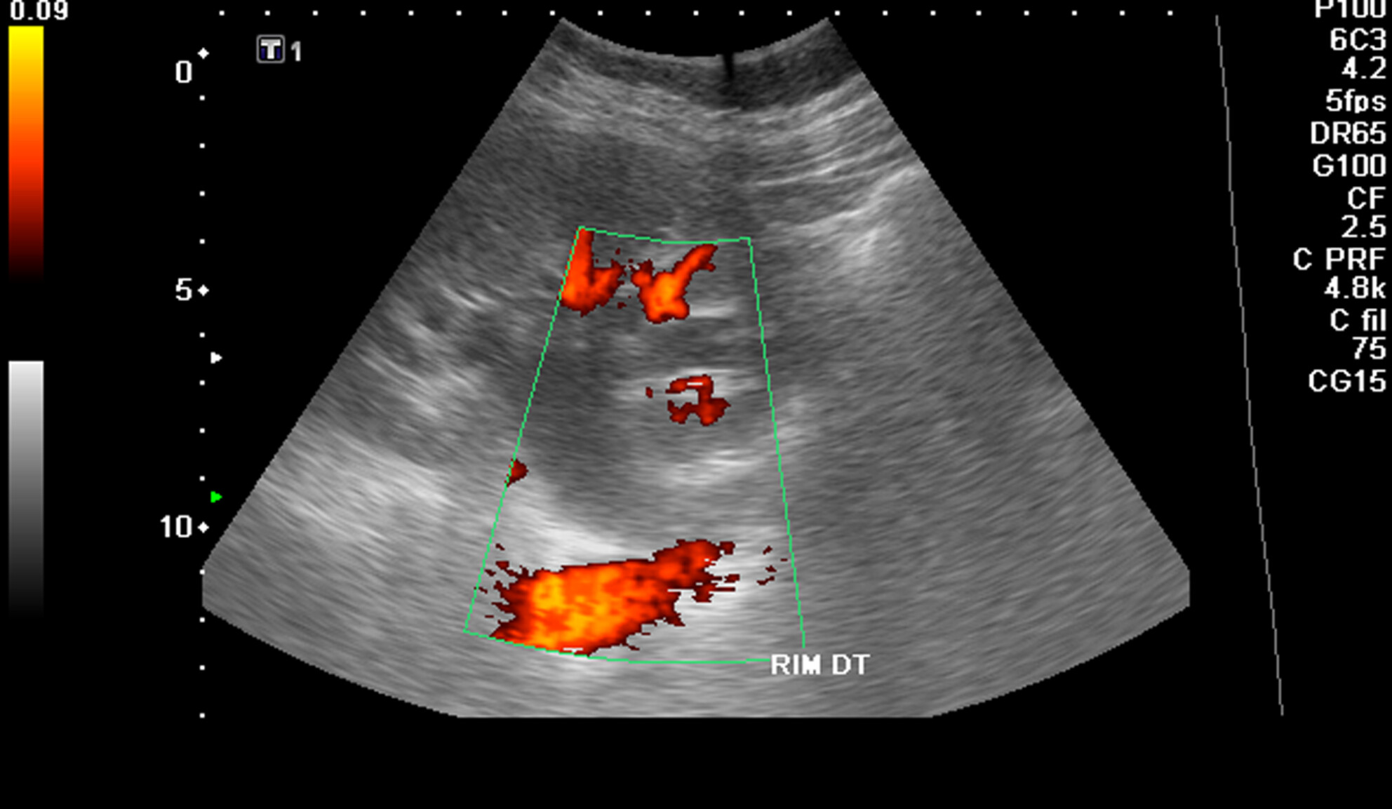 Renal screening sonography—A comparative study in a Portuguese basic emergency service