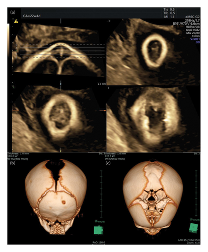 Details are in the caption following the image Details are in the caption following the image