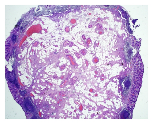Details are in the caption following the image